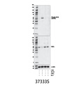 Phospho-MLKL (Ser345) (D6E3G) Rabbit mAb