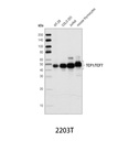 TCF1/TCF7 (C63D9) Rabbit mAb