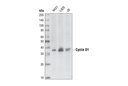 Cyclin D1 (92G2) Rabbit mAb