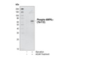 Phospho-AMPKα (Thr172) Antibody