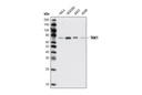 TAK1 (D94D7) Rabbit mAb