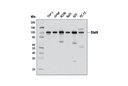 Stat6 (D3H4) Rabbit mAb