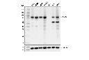 Stat3 (D1B2J) Rabbit mAb