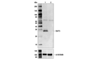 SirT3 (C73E3) Rabbit mAb