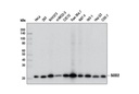 SOD2 (D3X8F) XP Rabbit mAb