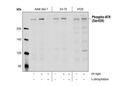 Phospho-ATR (Ser428) Antibody