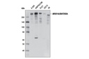 ARID1A/BAF250A (D2A8U) Rabbit mAb