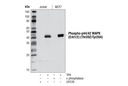 Phospho-p44/42 MAPK (Erk1/2) (Thr202/Tyr204) (D13.14.4E) XP Rabbit mAb (HRP Conjugate)