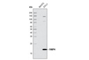 Adipogenesis Marker Antibody Sampler Kit