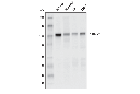 YTHDC1 (E4I9E) Rabbit mAb