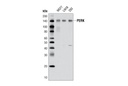 PERK (D11A8) Rabbit mAb