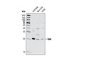 Bad (11E3) Rabbit mAb (IP Preferred)