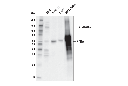 RARα (E6Z6K) Rabbit mAb