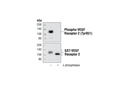 Phospho-VEGF Receptor 2 (Tyr951) (15D2) Rabbit mAb