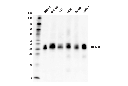 IGFBP3 (D1U9C) Rabbit mAb