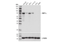 HNF1α (D7Z2Q) Rabbit mAb