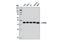 β-Actin (D6A8) Rabbit mAb