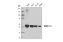ALDH1A1 (D9Q8E) XPRabbit mAb