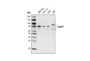 FoxP1 (D35D10) XP Rabbit mAb