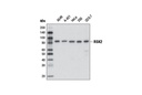 RSK2 (D21B2) XP Rabbit mAb