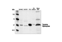Tyrosine Hydroxylase Antibody