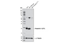 γ Secretase Antibody Sampler Kit