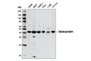 TMEM49/VMP1 (D1Y3E) Rabbit mAb
