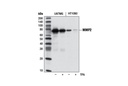 MMP-2 (D8N9Y) Rabbit mAb