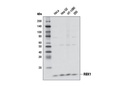 Ubiquitin E3 Ligase Complex Antibody Sampler Kit