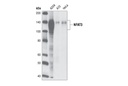NFAT3 (23E6) Rabbit mAb