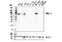 PKCβII (D9S2U) Rabbit mAb