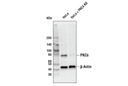 PKCδ (D10E2) Rabbit mAb