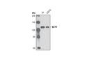 SirT1 (D60E1) Rabbit mAb (Mouse Specific)