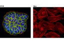 EpCAM (D4K8R) XP Rabbit mAb
