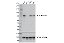 MLL2/KMT2B (D6X2E) Rabbit mAb (Carboxy-terminal Antigen)