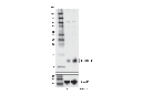p15 INK4B (E3R6S) Rabbit mAb