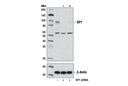SignalSilence SP1 siRNA I