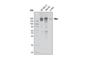 Mer (D21F11) XP Rabbit mAb
