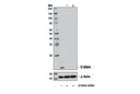 SignalSilence S100A4 siRNA I