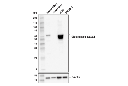 Glutaminase-1/GLS1 (E4T9Q) Rabbit mAb
