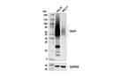 Glut1 (E4S6I) Rabbit mAb