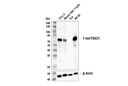 T-bet/TBX21 (E4I2K) Rabbit mAb