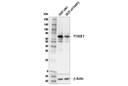 YTHDF2 (E2I2H) Rabbit mAb