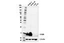 S100B (E7C3A) Rabbit mAb